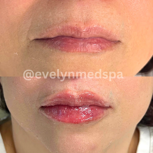 Evelyn Med Spa - Thumbnail