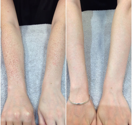 Skin Alert Cairns Skin Cancer and Cosmetic Clinic - Thumbnail