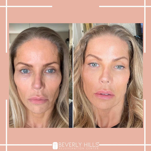 Beverly Hills Rejuvenation Center - Alliance - Thumbnail