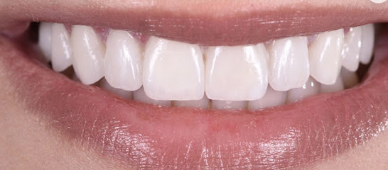 First Dental Implant Center-A Warner center advanced cosmetic dental center.