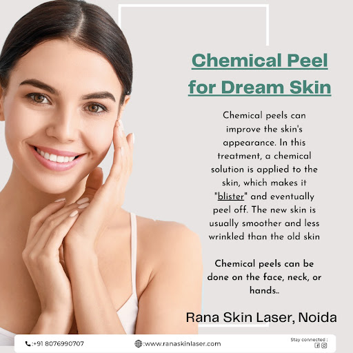 Achieve your dream skin with a chemical peel! This advanced treatment enhances your skin’s appear…