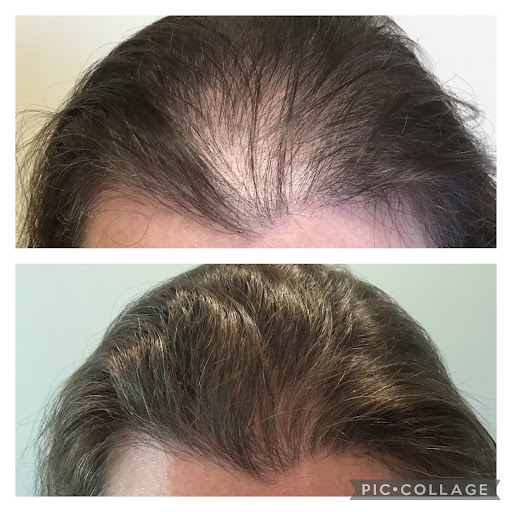 Mane Solution - Thumbnail