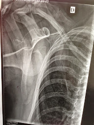 Photo n°15 de Docteur Marc-Olivier Falcone à Champigny-sur-Marne (Chirurgien orthopédiste)