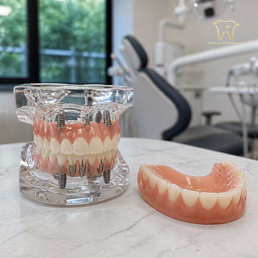 Tired of loose, uncomfortable dentures? At The Aligner Doc Dental Clinic in Kharghar, Navi Mumbai… post image