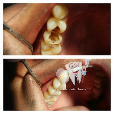 Photos of Family Dental Care Palagan