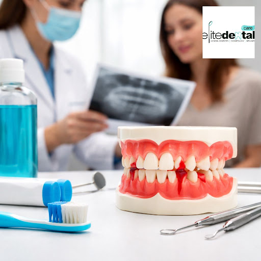 Bleeding gums are often the first sign that your gums need attention, not just a harder toothbrus… post image