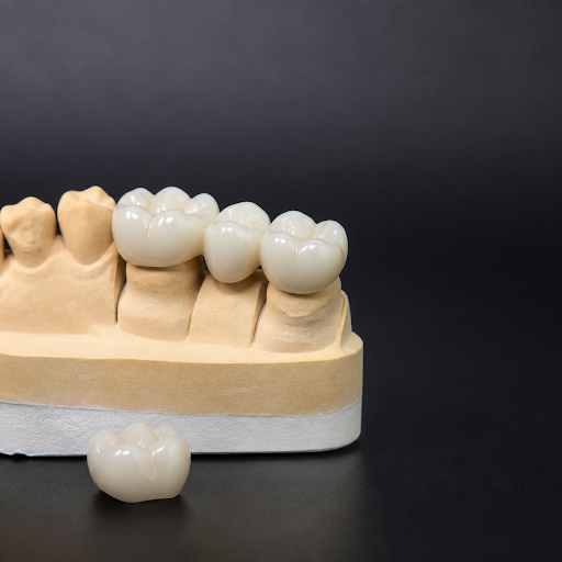Zirconia crowns are fast becoming the preferred option for long-lasting, natural-looking teeth re… post image