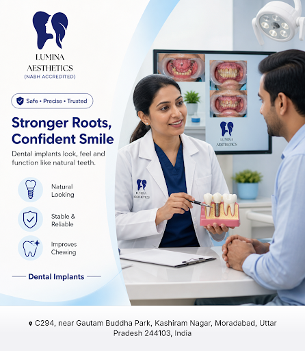 Lumina Aesthetics, a NABH accredited dental clinic, offers expert dental implant solutions for a… post image