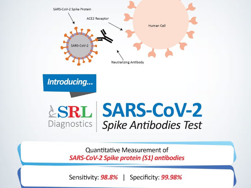 Covid antibody test post image