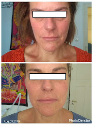 Photo n°12 de Valérie Heitz - Diététique chinoise, Acupuncture anti-âge du visage à Strasbourg (Centre de bien-être)