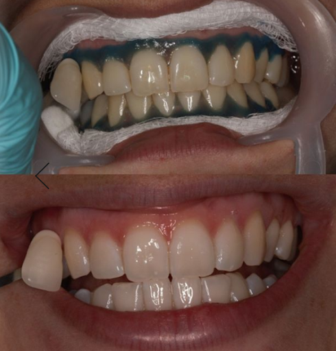 Dental Delight - Thumbnail