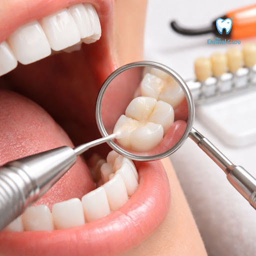Want to fix cavities without anyone noticing? At The Dental Care -Tirunelveli, we use advanced to… post image