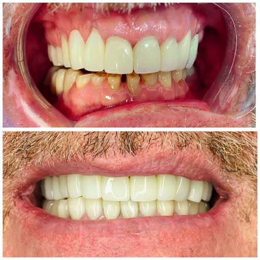Dentist Near Me Chino