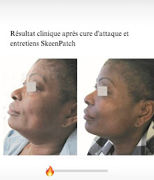 Photo n°19 de Centre de soins anti âge et maquillage permanent Coryne Dermo à Villefranche-sur-Saône (Centre de bien-être)