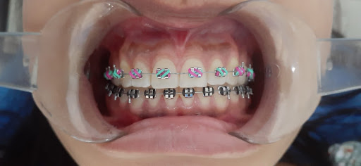 Kapi dental - Visual