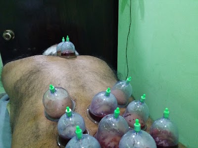 Photos of Hijama Planet