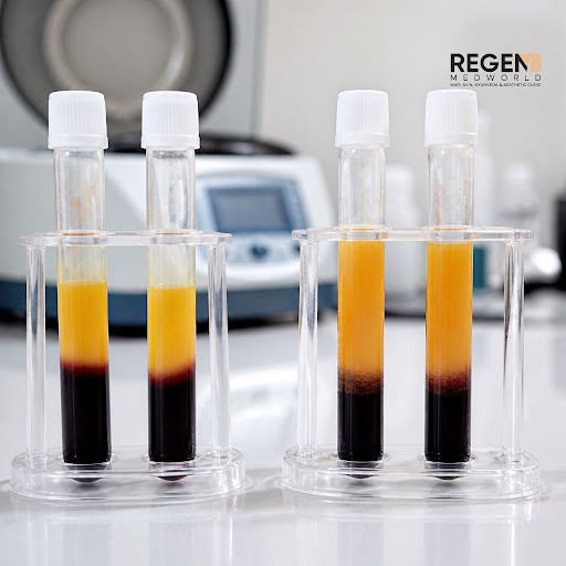 Wondering whether GFC or PRP is better for your hair regrowth? At REGEN MEDWORLD in Kureepuzha, K… post image