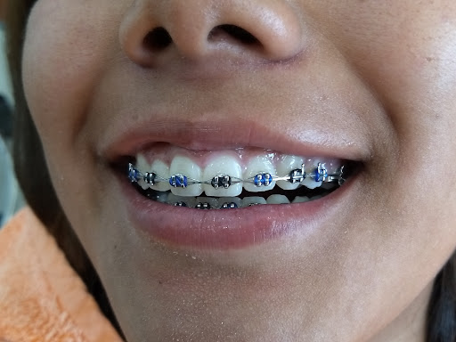 Dentista, odontología general, cosmética dental, implantes ortodoncia - Thumbnail