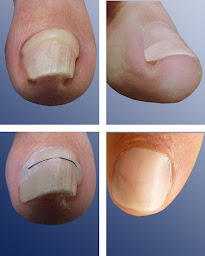 Photo n°6 de Gaudin Sophie Pédicure Podologue à Pont-Saint-Esprit (Podologue)