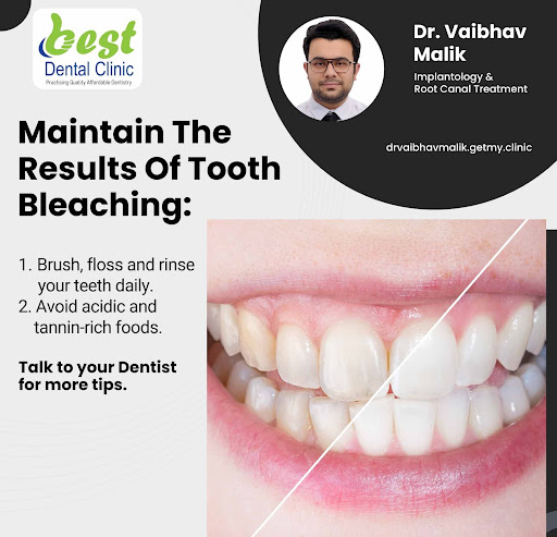 Tooth whitening is either the restoration of a natural tooth shade or whitening beyond the natura… post image