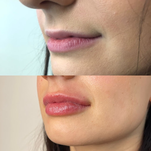 Beauty Barn Medical Spa - Thumbnail