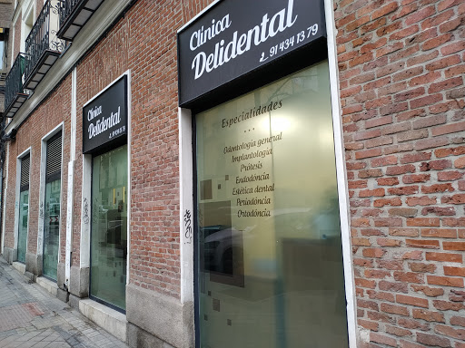 Clinica Delidental Madrid