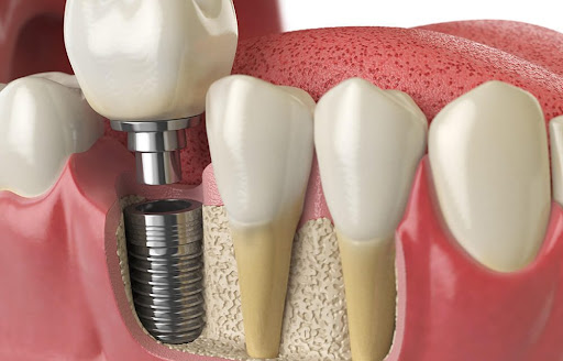 Dentimad - Centre dentaire Saint Lazare Paris 9 - Thumbnail