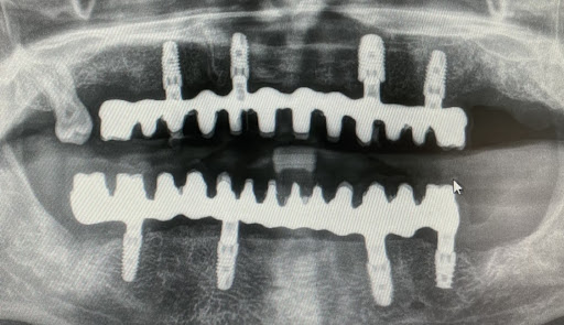 CLINICA DENTAL GARCIA DEL CANTO SLP - Thumbnail