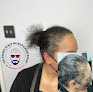 Hair transplant clinic Delaware Scalp Micropigmentation in Wilmington