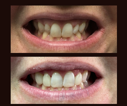 Denta Dental of Hobbs - Thumbnail