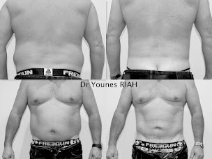 Photo n°13 de Docteur Younes RIAH à Bastia (Chirurgien plasticien)