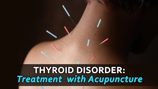 Naturally Appointed Acupuncture and Holistic Wellness Clinic Gallery - United States