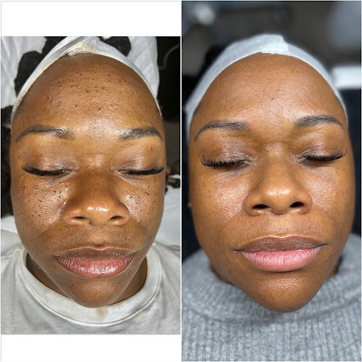 Belle Choses Esthetics Studio - Thumbnail