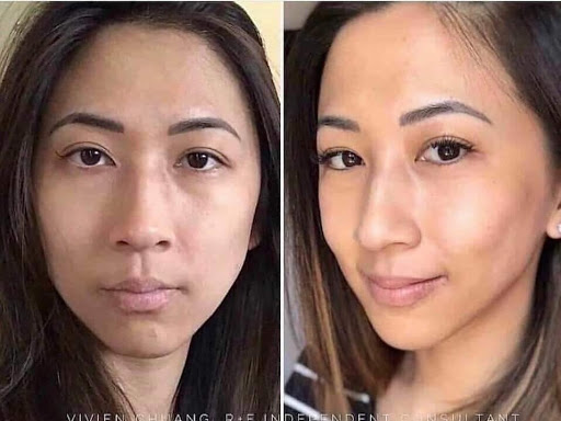 Facial rejuvenation services