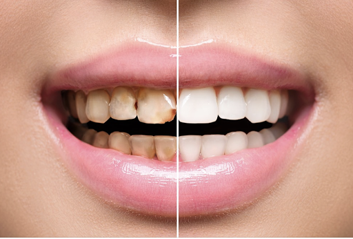 Westchester Dental Care - Thumbnail