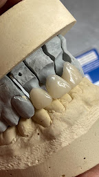 Photo n°9 de Amestoy Nicolas - LaboToy à Biarritz (Centre de prothèses dentaires)