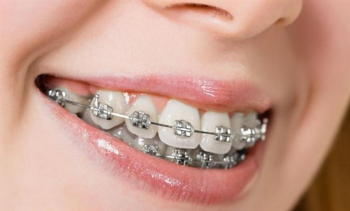 Facial injuries, misaligned jaws, or chronic bite issues can impact not only your appearance but…