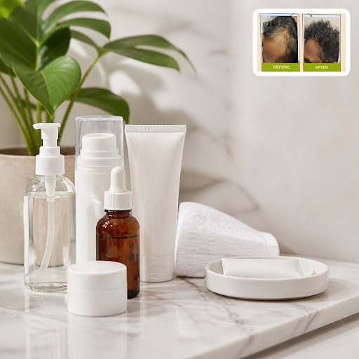 Struggling with recurring pimples, marks or oily skin? At Dr Akankshas skin clinic in Tilak Chowk… post image