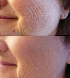 Photo n°10 de Centre Laser Murano Bayeux à Bayeux (Centre médical)