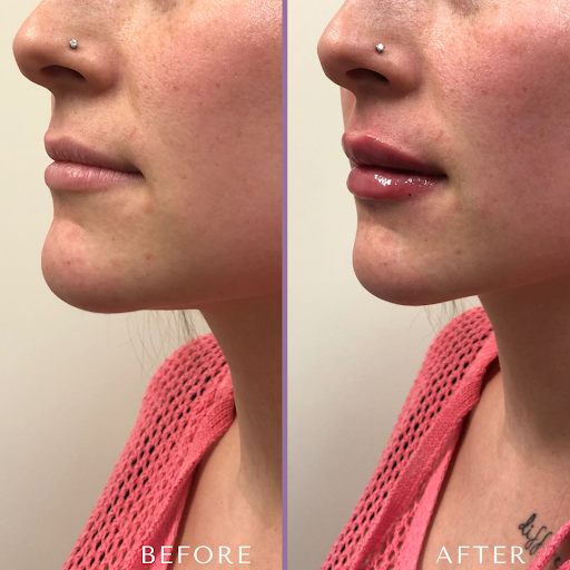 Snatched Doll Aesthetics