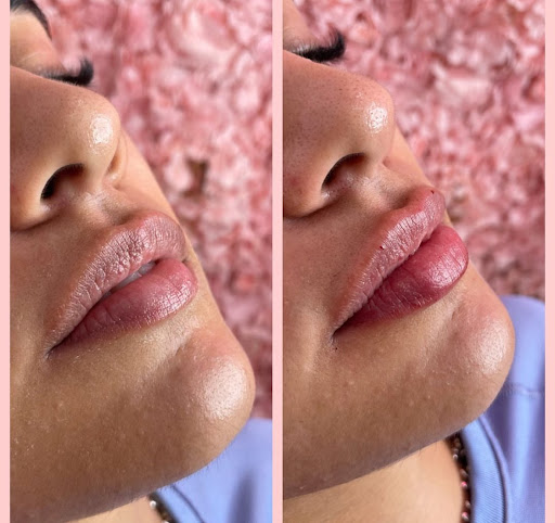 Facial Mania Med Spa