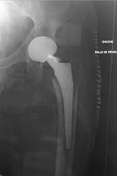 Photo n°4 de Dr Alexandre ZADEM à Saint-Grégoire (Chirurgien orthopédiste)