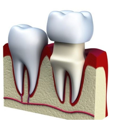 Hazel Dell Dentistry 4 Children - Thumbnail