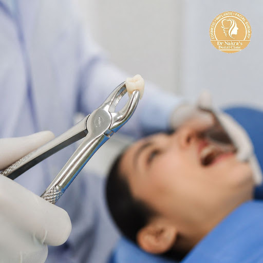 Worried about tooth removal? At Dr Nakra's Dental Clinic in Surya Nagar, Ghaziabad, we use advanc… post image