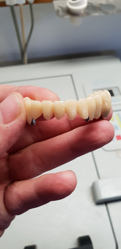 TECNODENTAL di Montagnoli Fabio LAB.PROTESI DENTALE - Thumbnail