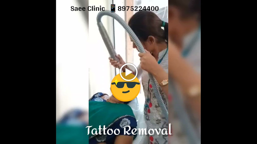 Saee Skin Hair Obesity Laser Clinic Best Skin Hair Specialist In Khopoli