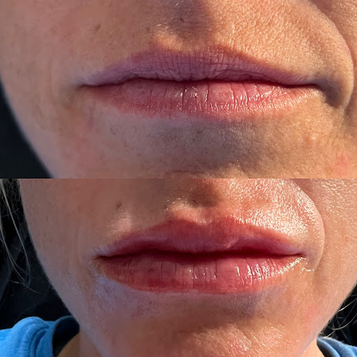 Revived Medical Aesthetics