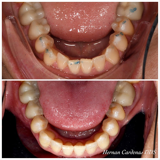 Cardenas Hernan DDS - Thumbnail
