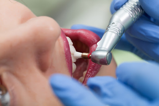Ambulatorio Dentistico Sanbenedetto Srl - Thumbnail