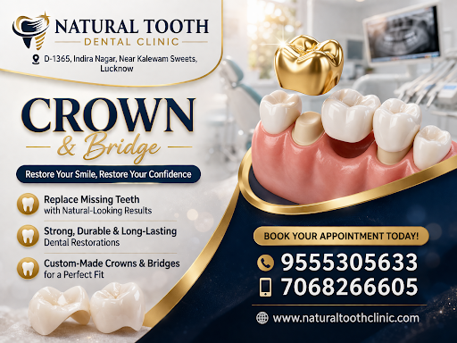Restore your beautiful smile with advanced Crown & Bridge treatment at Natural Tooth Dental Clini… post image